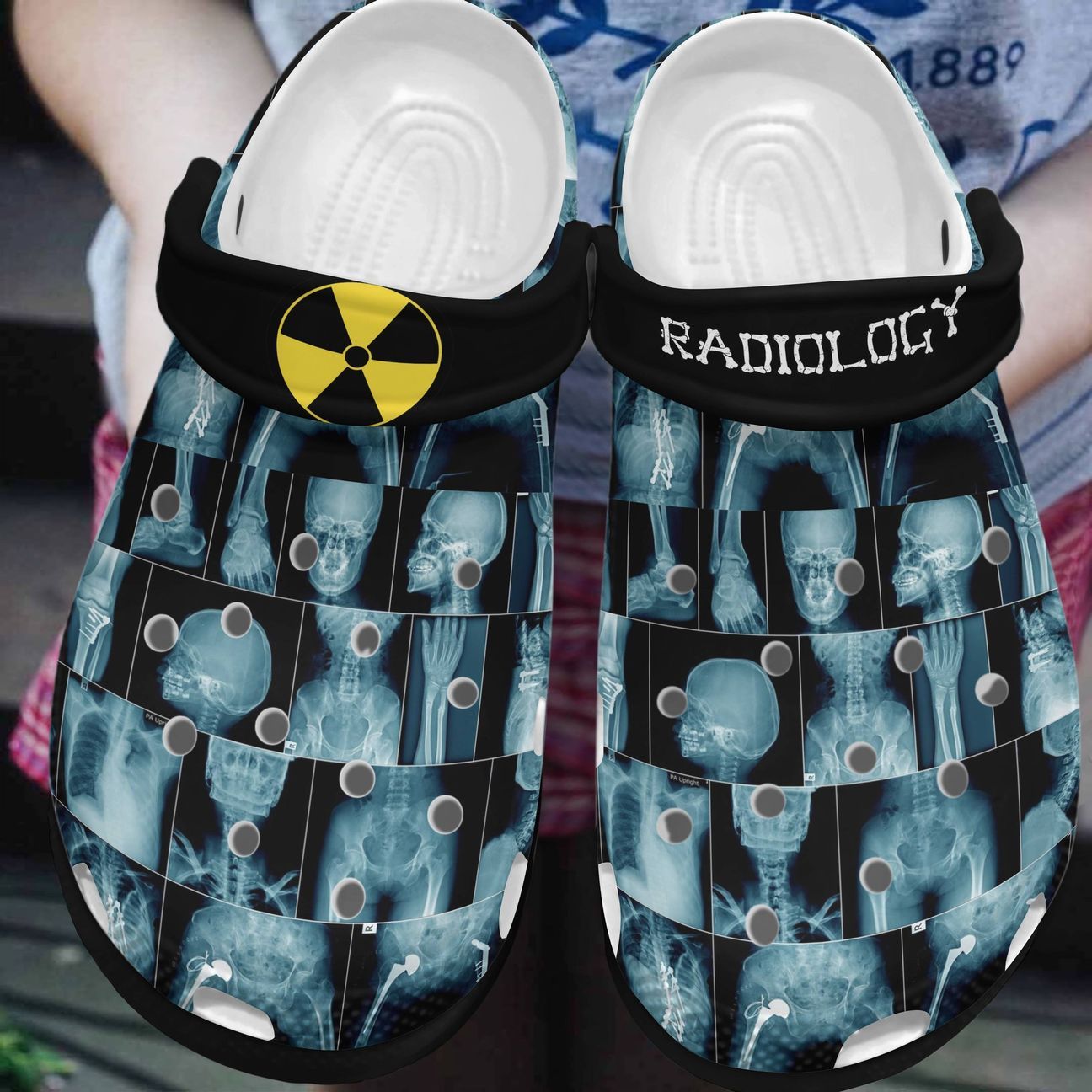 Rad Tech Personalized Clog Custom Crocs Comfortablefashion Style Comfortable For Women Men Kid Print 3D Radilology Life